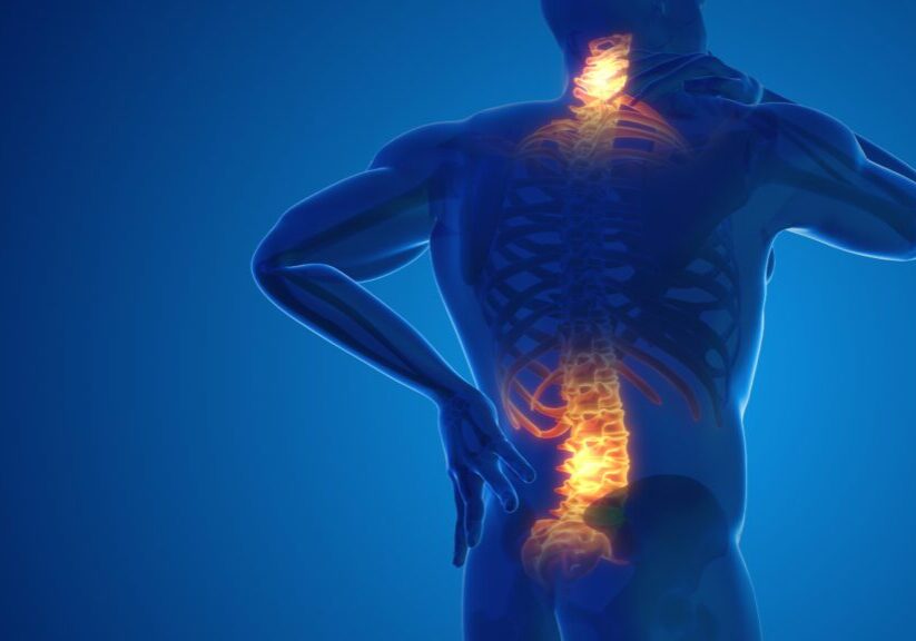 Illustration of spinal inflammation causing back pain.